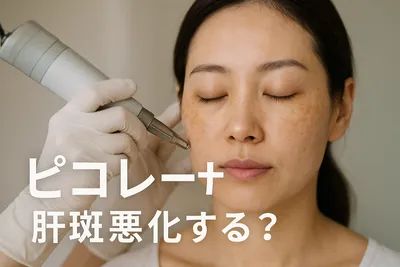 ピコ レーザー 肝斑 悪化する？