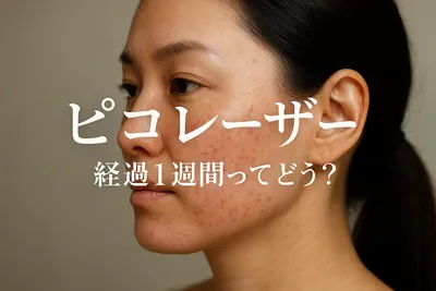 ピコ レーザー 経過 1週間ってどう？