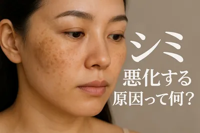 シミ 悪化する原因って何？